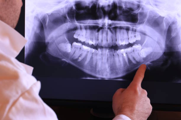 Best Emergency Dental Surgery in Oakridge, OR