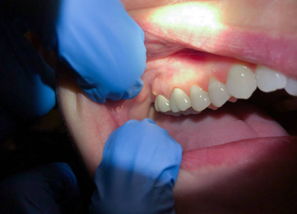 Best Emergency Dental Care for Trauma or Injury in Oakridge, OR