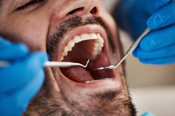 Best Emergency Tooth Extraction in Oakridge, OR