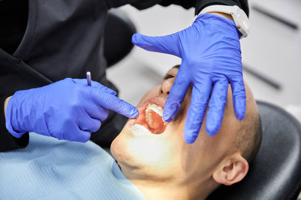 Best Emergency Tooth Extraction in Oakridge, OR
