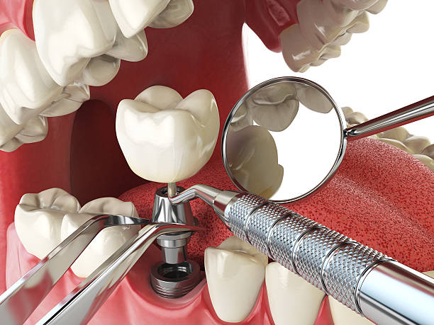 Best Emergency Dental Care for Trauma or Injury in Oakridge, OR