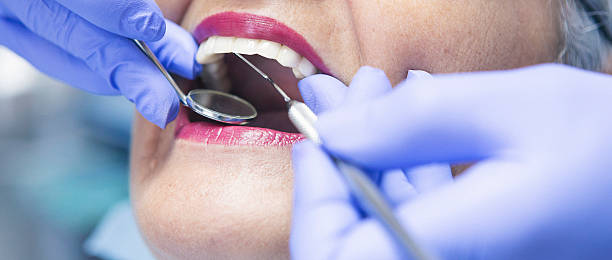 Best Emergency Root Canal Treatment in Oakridge, OR